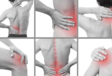 La définition et les causes des troubles musculo-squelettiques TMS Musculoskeletal Injuries Treatments Omaha 1200x900 1