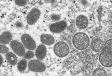 Variole du singe : le chef de l'OMS dira ce samedi s'il déclenche le niveau d'alerte le plus élevé Vue au microscope de la variole du singe en 2011 1418683
