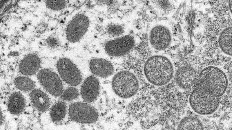 Variole du singe : le chef de l'OMS dira ce samedi s'il déclenche le niveau d'alerte le plus élevé Vue au microscope de la variole du singe en 2011 1418683