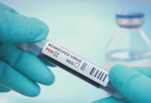 9 mythes sur la variole du singe sur les symptômes, le traitement et la façon dont il se propage monkeypox virus test royalty free image 1659727725