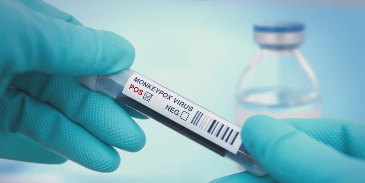 9 mythes sur la variole du singe sur les symptômes, le traitement et la façon dont il se propage monkeypox virus test royalty free image 1659727725