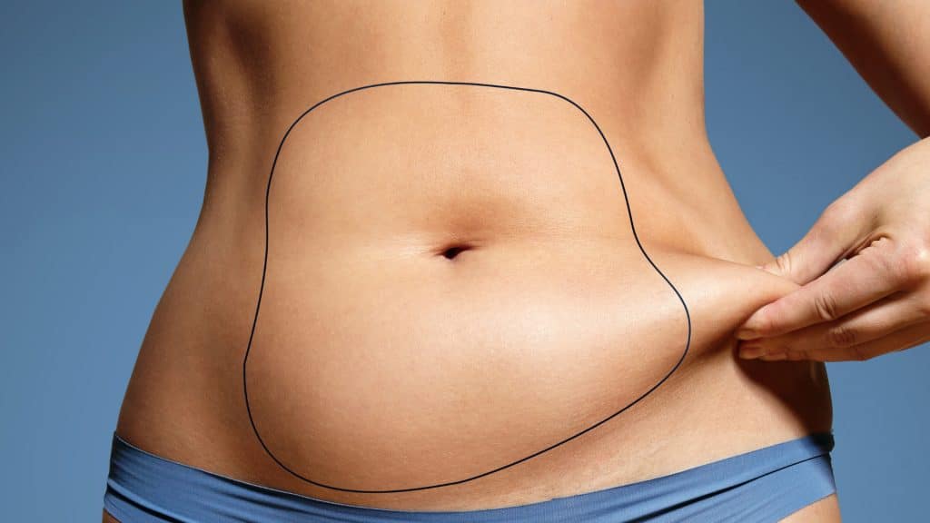 La liposuccion: tout savoir sur cette opération de chirurgie esthétique lipo ventre 01 1024x576 1